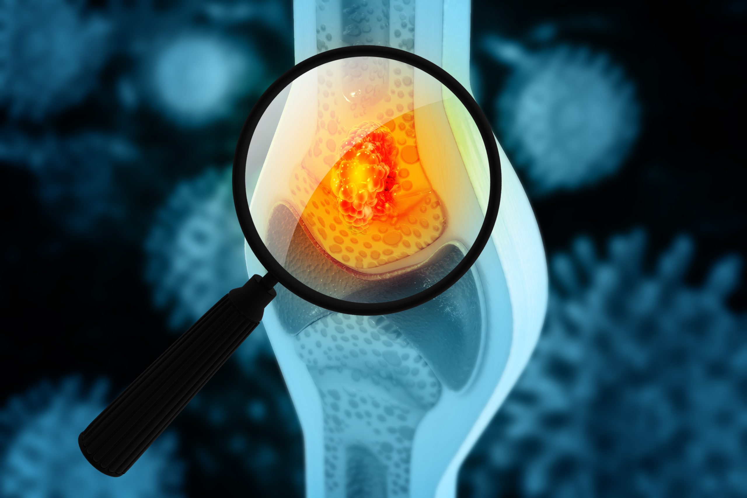 Ostx Biopharma Mover: OS Therapies (OSTX) Announces Q2 Earnings - PRISM ...
