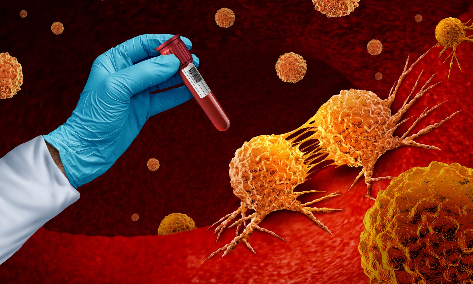 A gloved hand holding a test tube filled with blood near illustrated cancer cells under a microscope, representing cancer research and diagnostics.