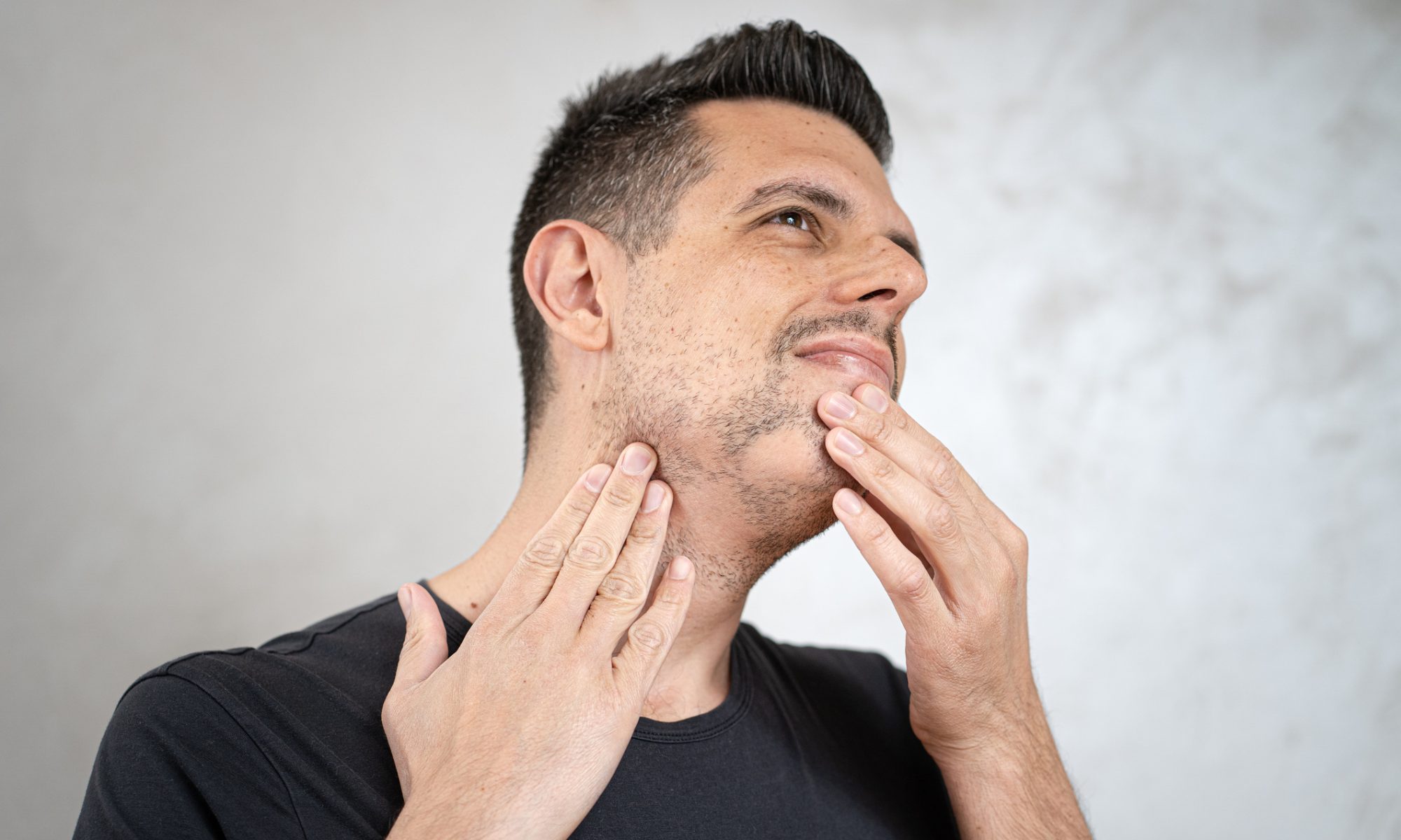 Man examining hair and jawline, representing alopecia areata as Rezolute reports Phase 2b proof-of-concept results for rezpegaldesleukin.