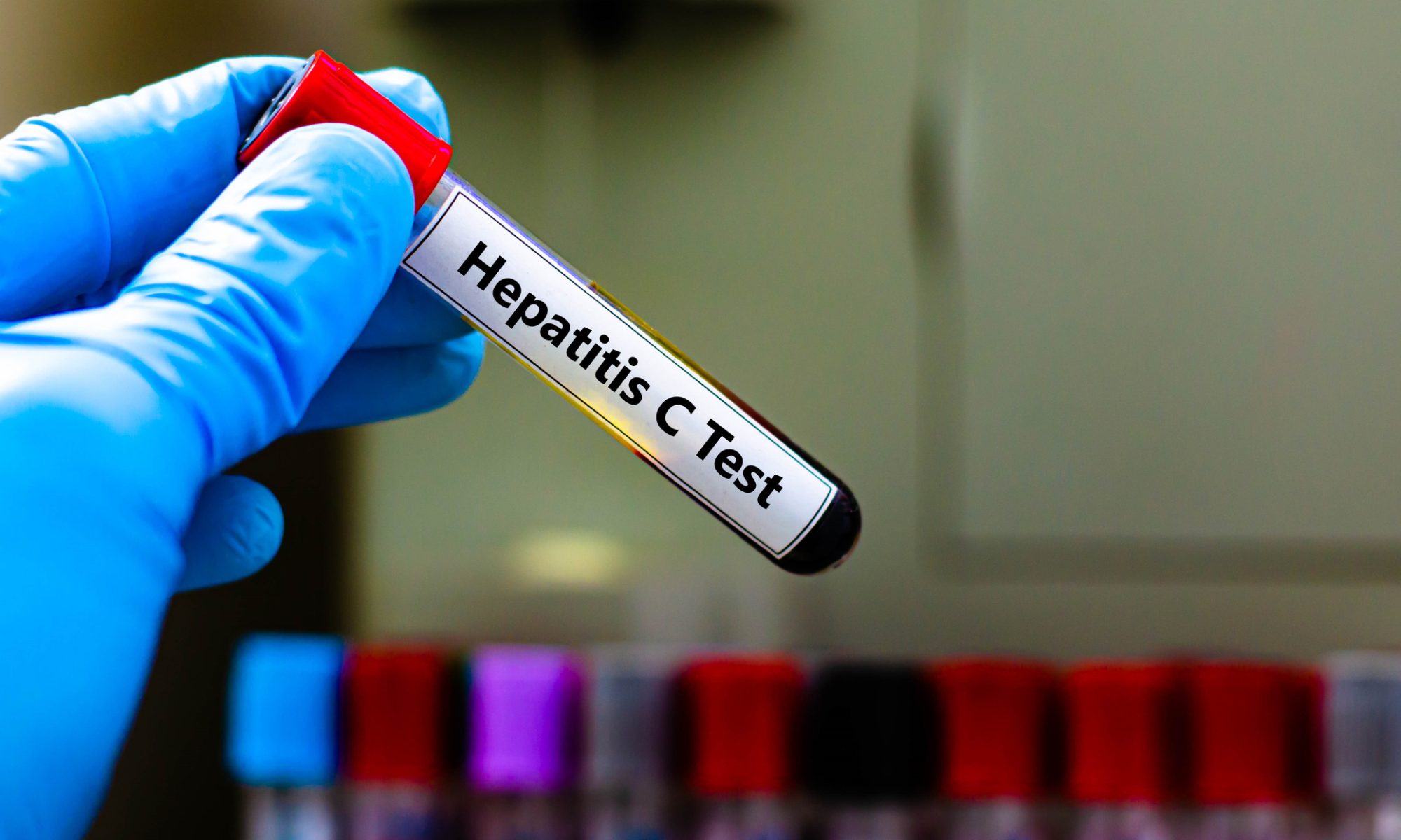 Atea Pharmaceuticals Completes Enrollment in North American Phase 3 Hepatitis C Trial