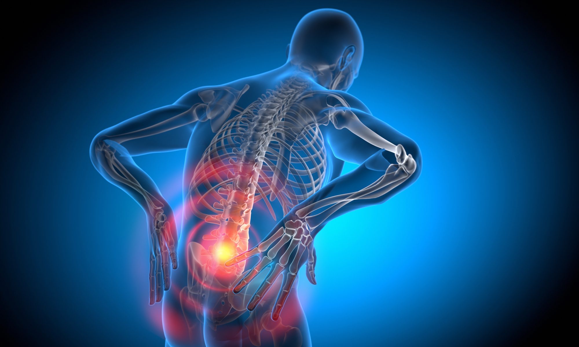 ACON Advancing the care of patients suffering from chronic lower back pain