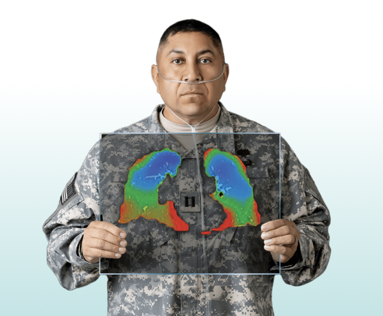 4DMedical secures over $100M to expand its FDA-cleared CT:VQ™ lung imaging platform across the U.S., accelerating adoption and R&D.
