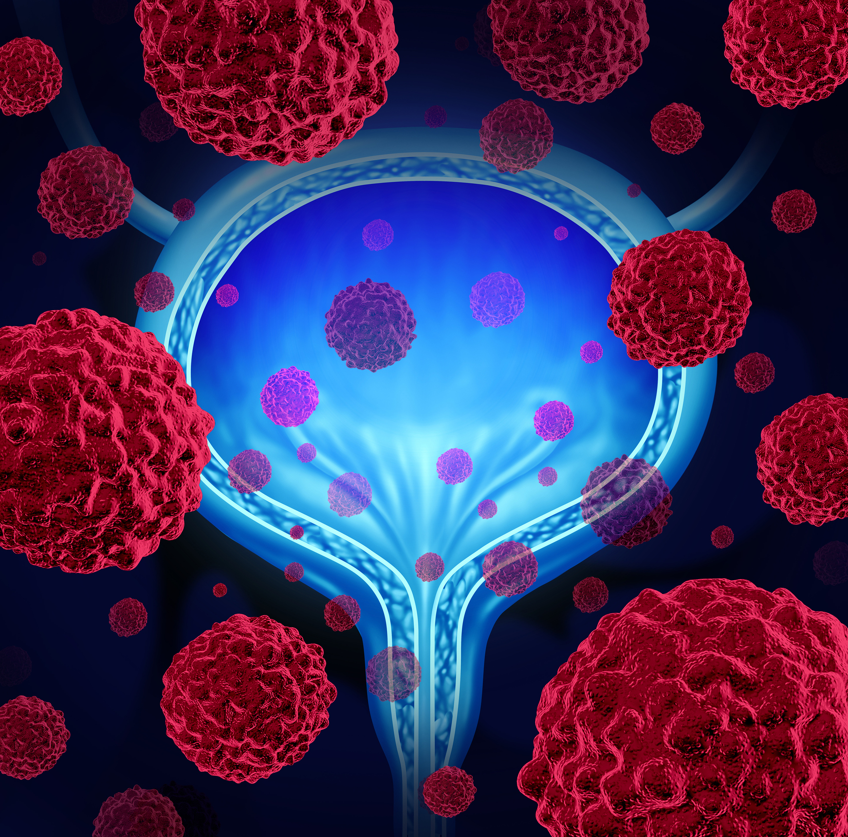 ImmunityBio Shares Jump After EU Green Light for Bladder Cancer ...