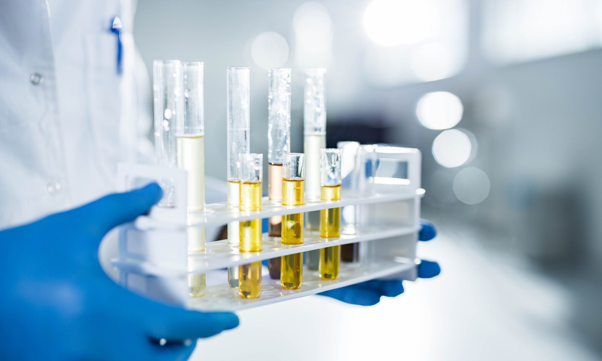 Solid Biosciences secures an oversubscribed $240M private placement to fund pipeline development and corporate growth. Shares surge 14% on investor confidence.