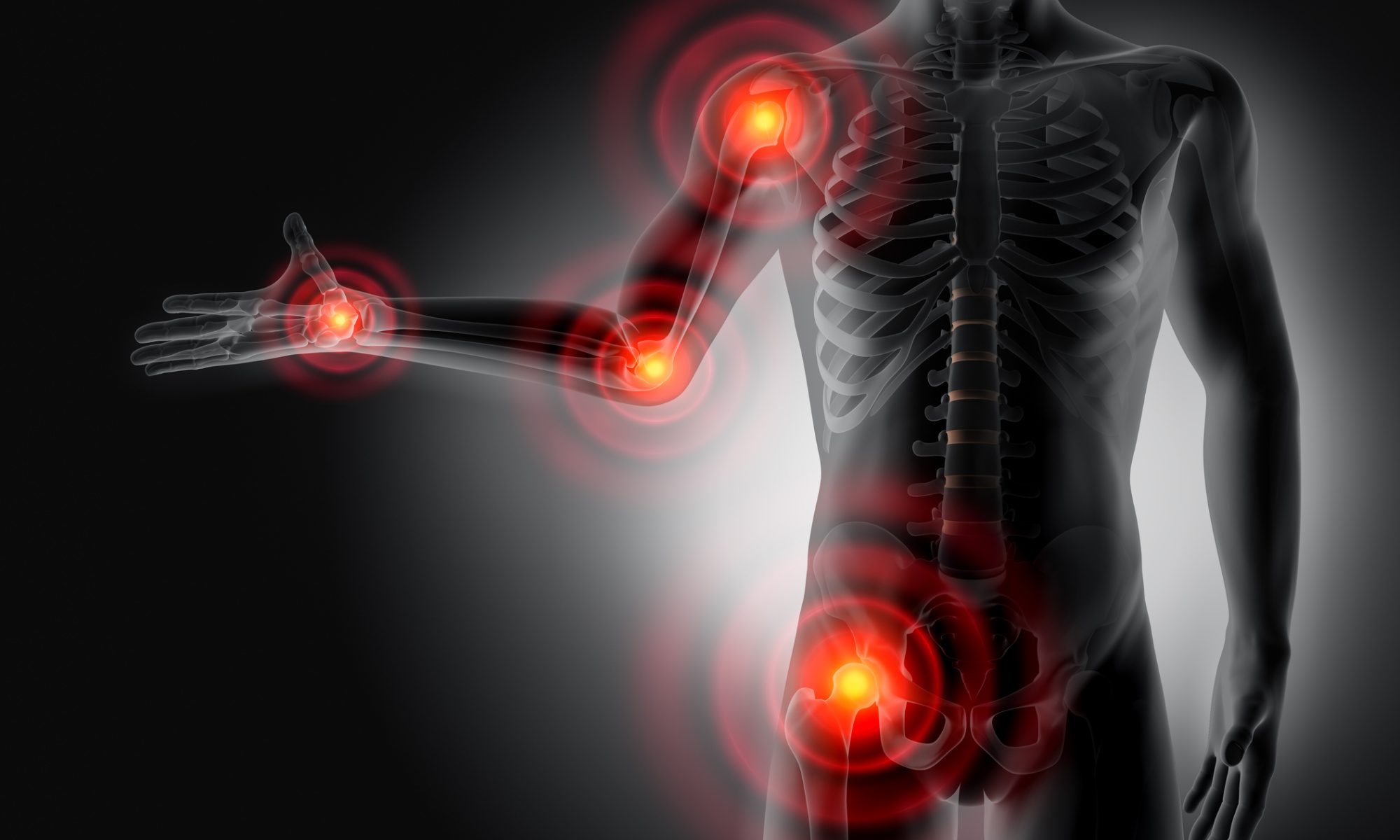 Immunovant stock surges 20% after IMVT-1402 delivers strong ACR response rates in difficult-to-treat rheumatoid arthritis trial at Week 16.
