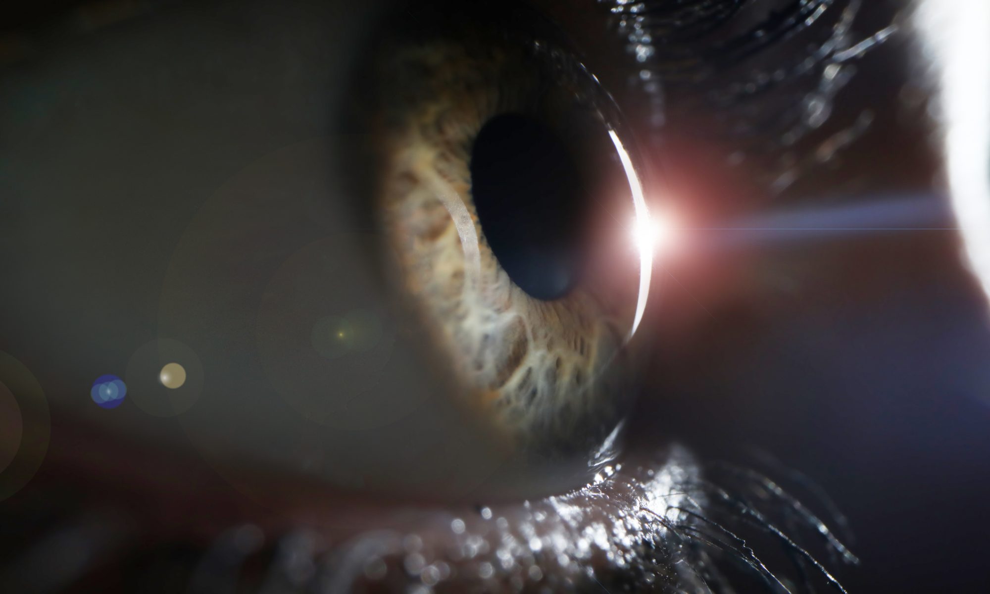 Outlook Therapeutics is a biopharmaceutical company focused on the development and commercialization of ONS-5010/LYTENAVA™ (bevacizumab-vikg; bevacizumab gamma) for the treatment of retina diseases, including wet AMD.