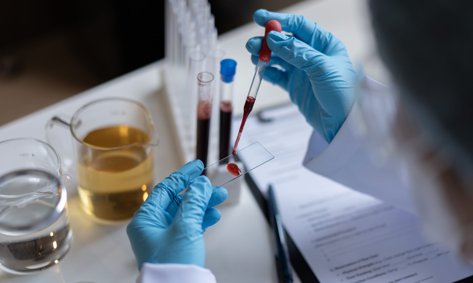 Caris Life Sciences Launches Caris Detect, a Multi-Cancer Early ...