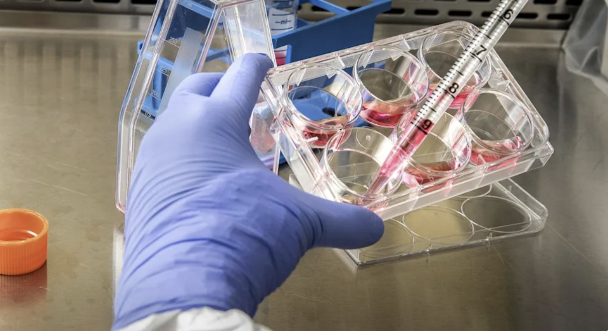 Nuvectis Pharma (NASDAQ: NVCT) targets a $9.8B oral PNH market with NXP100, whose Phase 3 data beat the infused standard 59.5% to 8.3% on hemoglobin response.