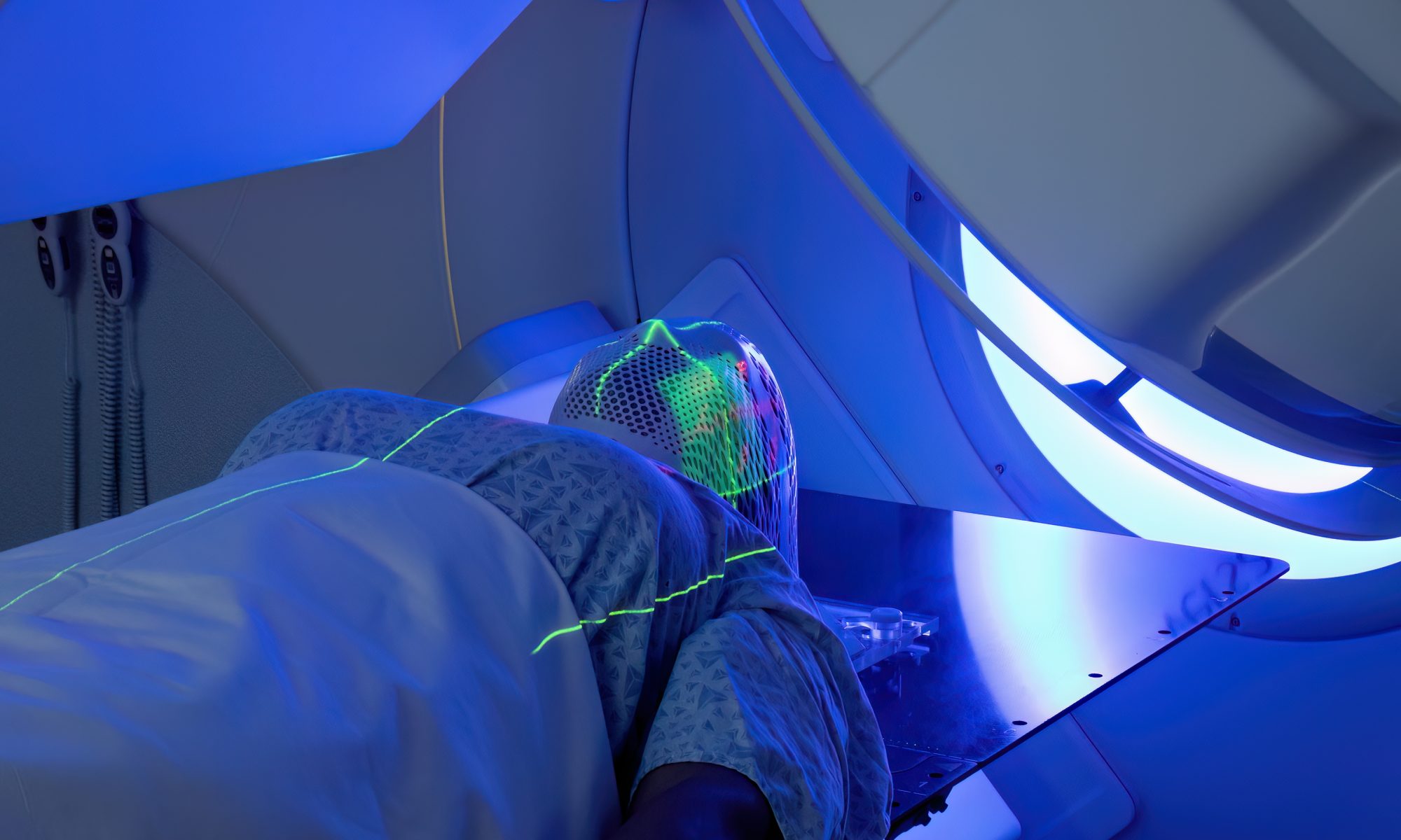 A patient lies on a treatment table wearing a fitted radiation therapy mask while a modern radiotherapy machine is positioned overhead. Green laser alignment beams mark the treatment area, illustrating precision radiation therapy and advanced targeted cancer treatment.