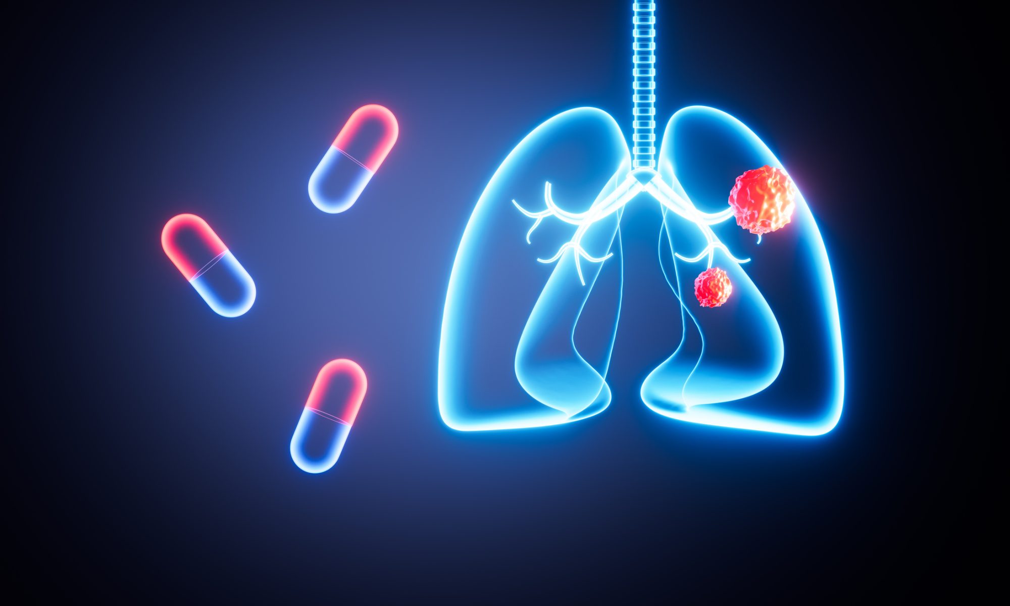 Digital illustration of human lungs with cancer cells and targeted treatment capsules, representing Nuvation Bio’s IBTROZI therapy for ROS1-positive non-small cell lung cancer.
