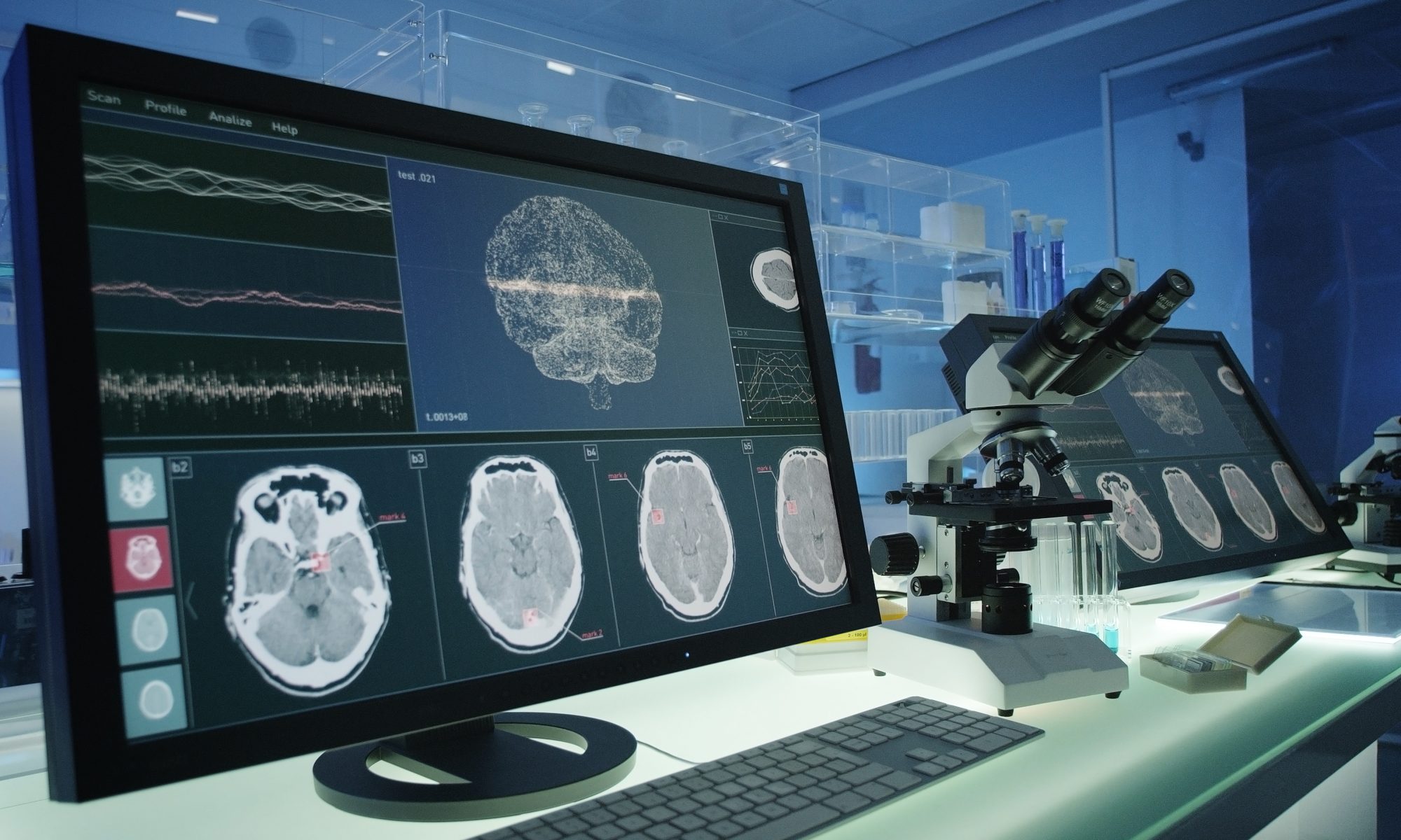 Advanced neuroscience laboratory with brain scans displayed on monitors, representing Alzamend Neuro’s AL001 lithium brain-imaging research using high-field MRI technology.