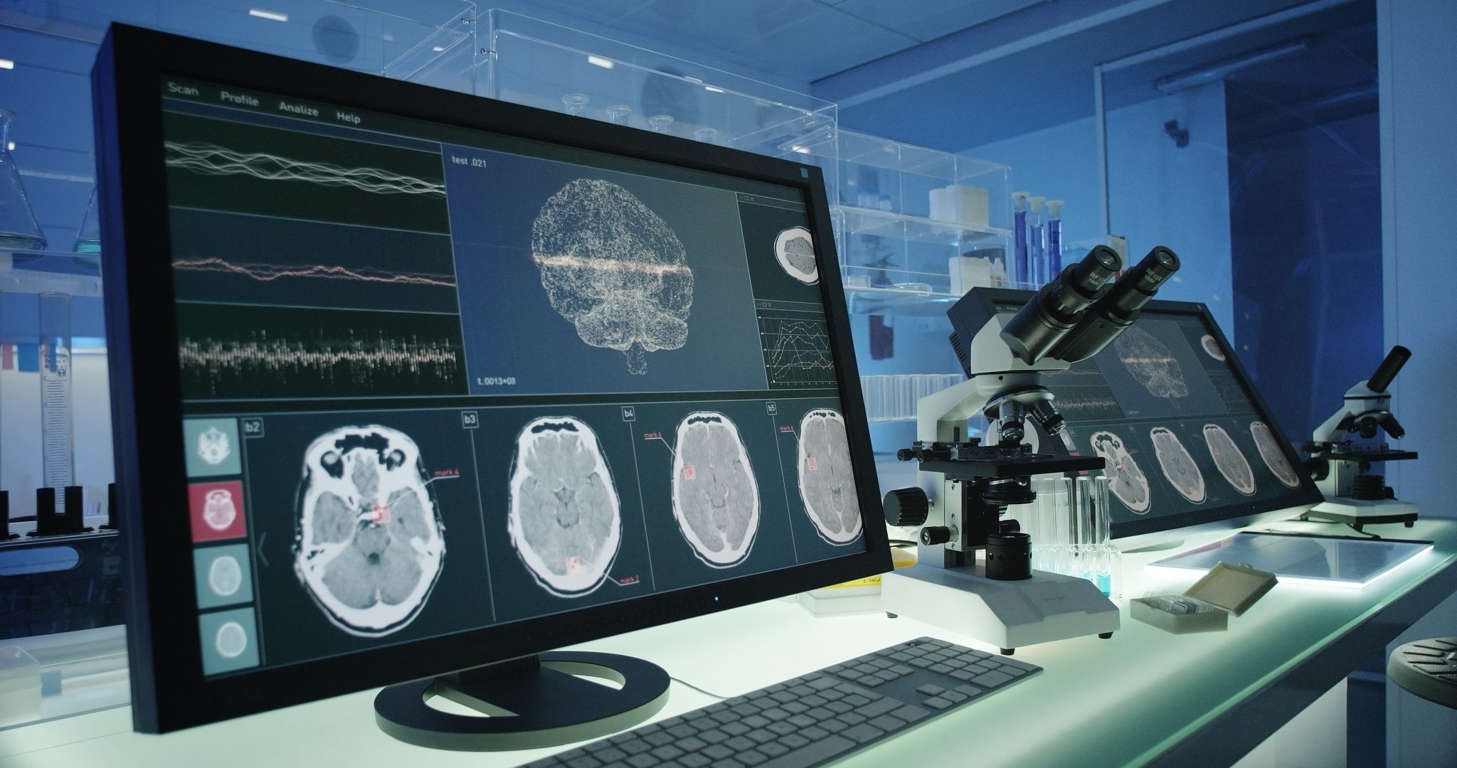 Advanced neuroscience laboratory with brain scans displayed on monitors, representing Alzamend Neuro’s AL001 lithium brain-imaging research using high-field MRI technology.