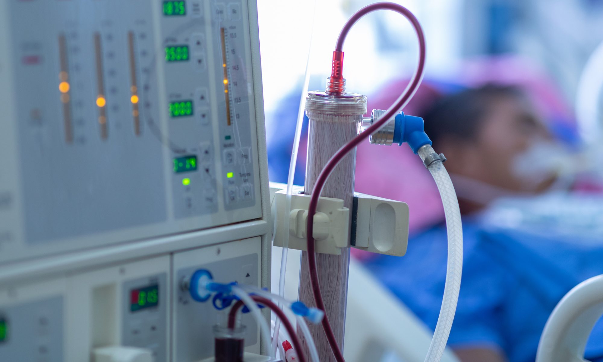 Hemodialysis machine and blood-filtration equipment beside a patient, representing Humacyte’s research into ATEV vascular access for patients with end-stage kidney disease.