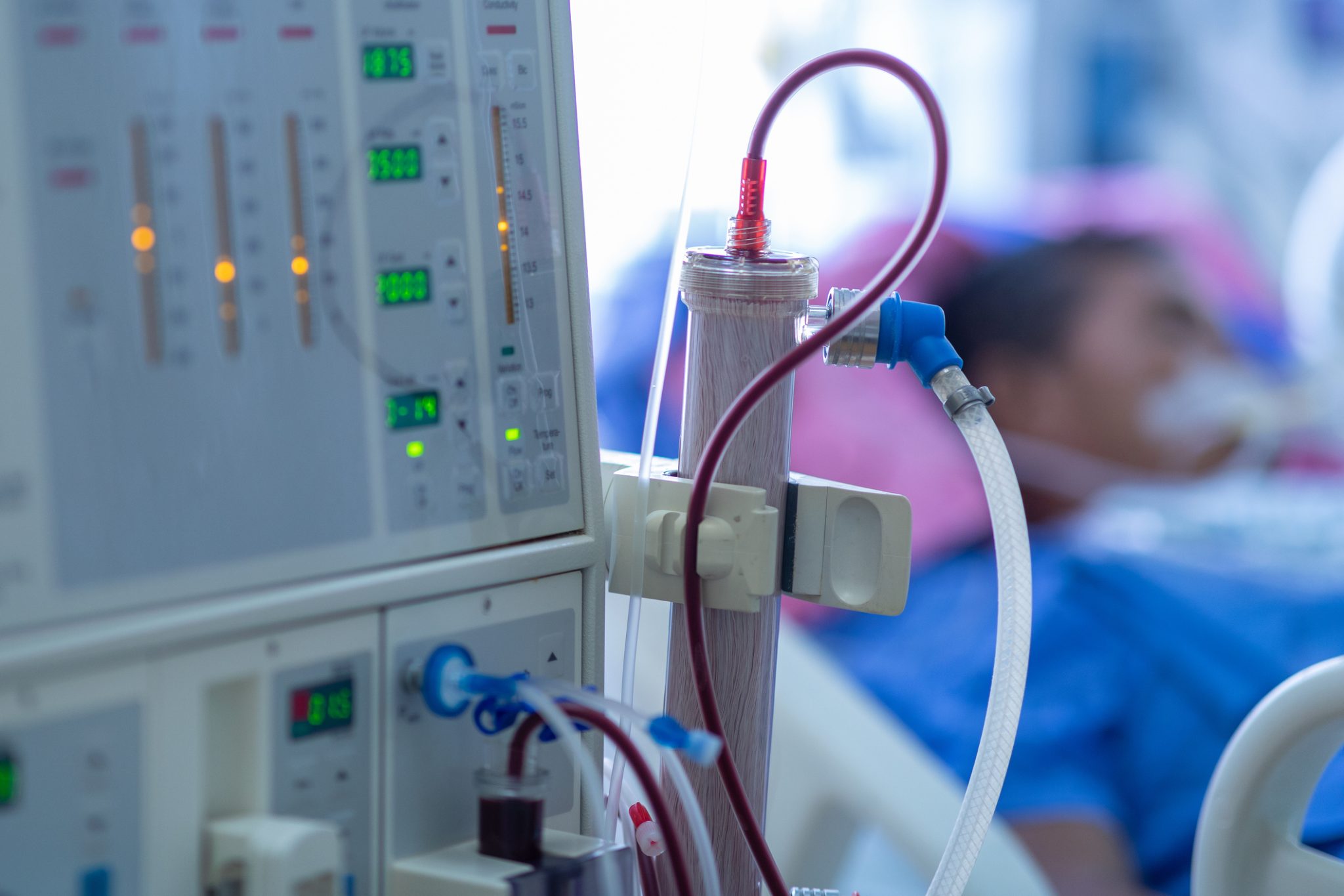 Hemodialysis machine and blood-filtration equipment beside a patient, representing Humacyte’s research into ATEV vascular access for patients with end-stage kidney disease.