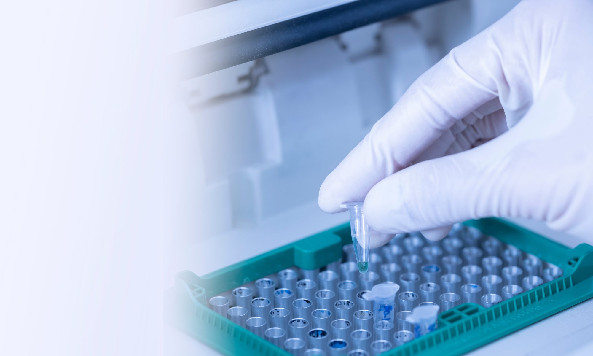 Laboratory technician handling a sample vial during pharmaceutical research, illustrating Quoin Pharmaceuticals’ clinical development of QRX003 for Netherton Syndrome.