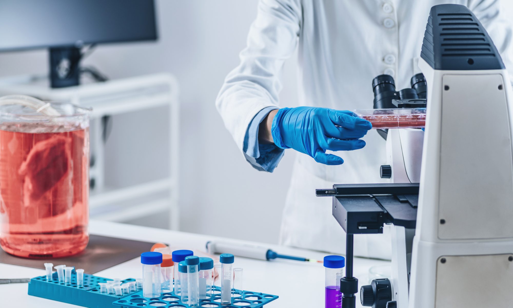 Scientist examining laboratory samples under a microscope, representing PDS Biotechnology’s cancer immunotherapy research and clinical development programs.