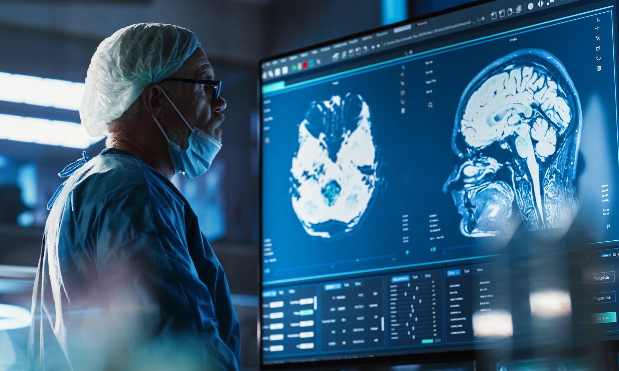 Medical professional reviewing detailed brain scans on large imaging monitors, representing PET imaging used to evaluate glioma brain cancer.