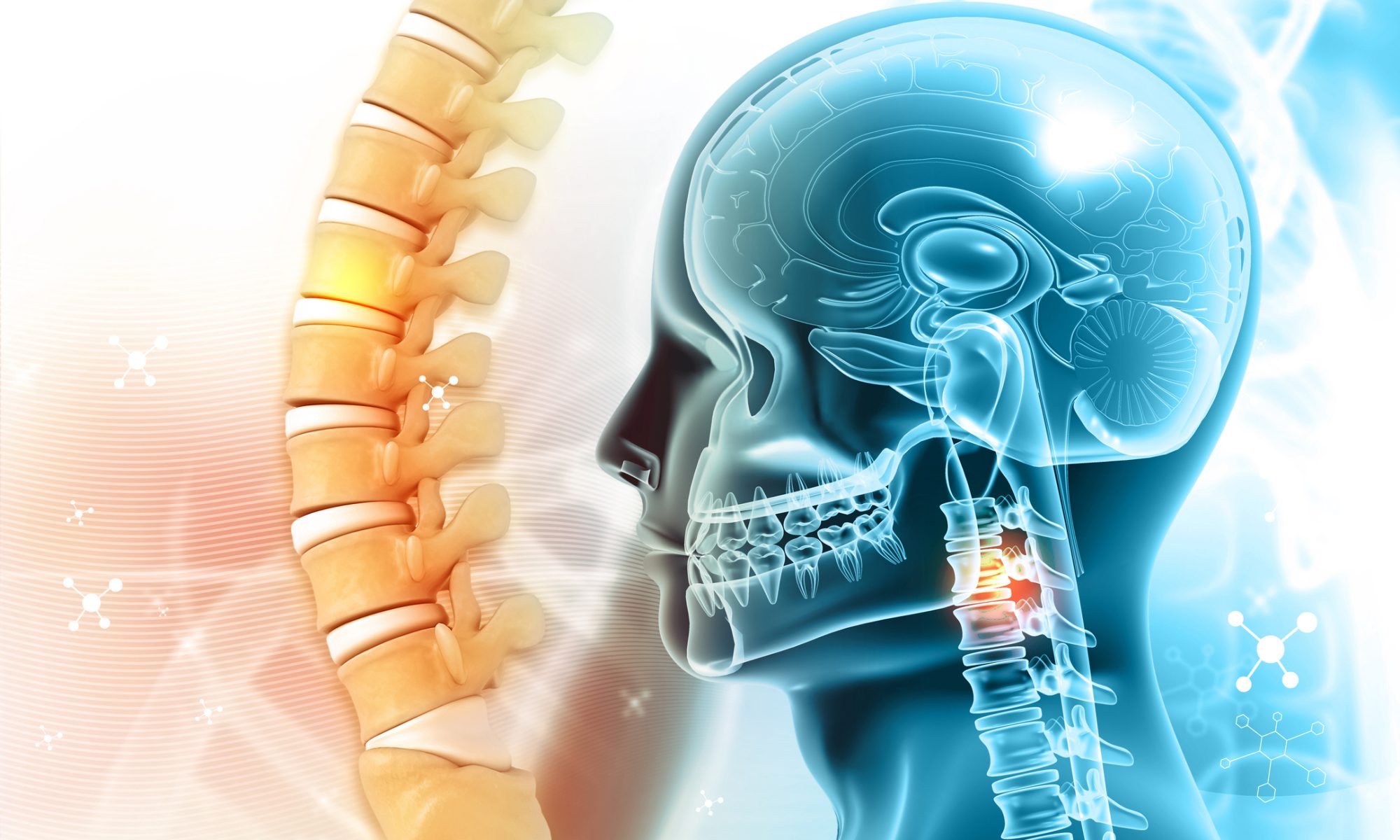 Medical illustration of the human brain and spine highlighting neurological disease, representing research into treatments for high-grade glioma.