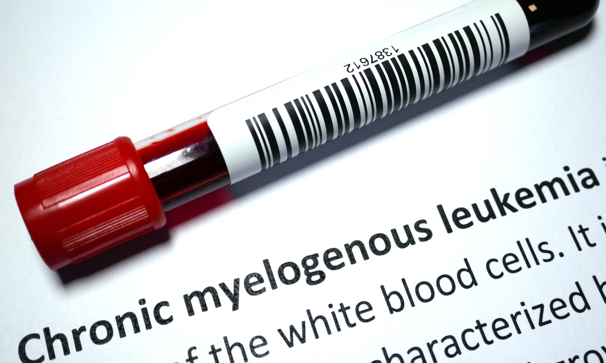 Blood sample tube beside information about chronic myelogenous leukemia, representing clinical research into new CML treatments.