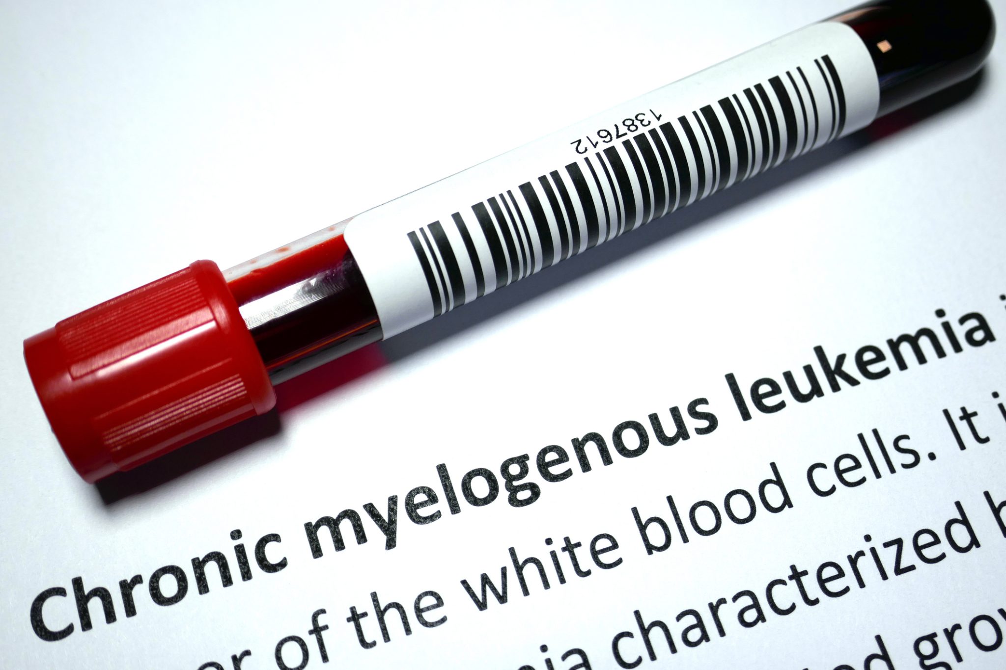 Blood sample tube beside information about chronic myelogenous leukemia, representing clinical research into new CML treatments.