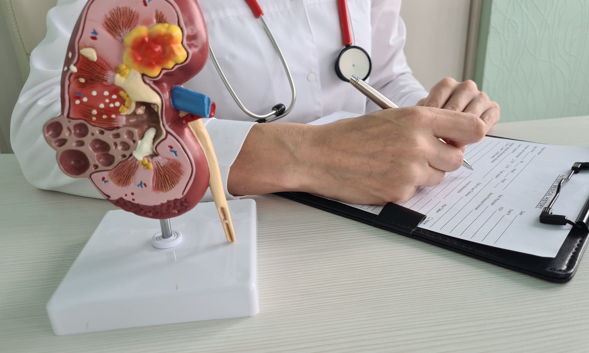 Medical professional reviewing patient records beside an anatomical kidney model, illustrating medical research, kidney function and investigational cancer therapies.