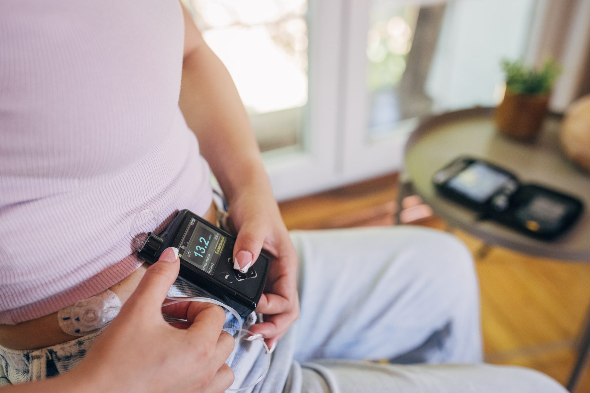 Person using a wearable insulin pump to manage type 1 diabetes, illustrating automated insulin delivery technology and blood sugar management.