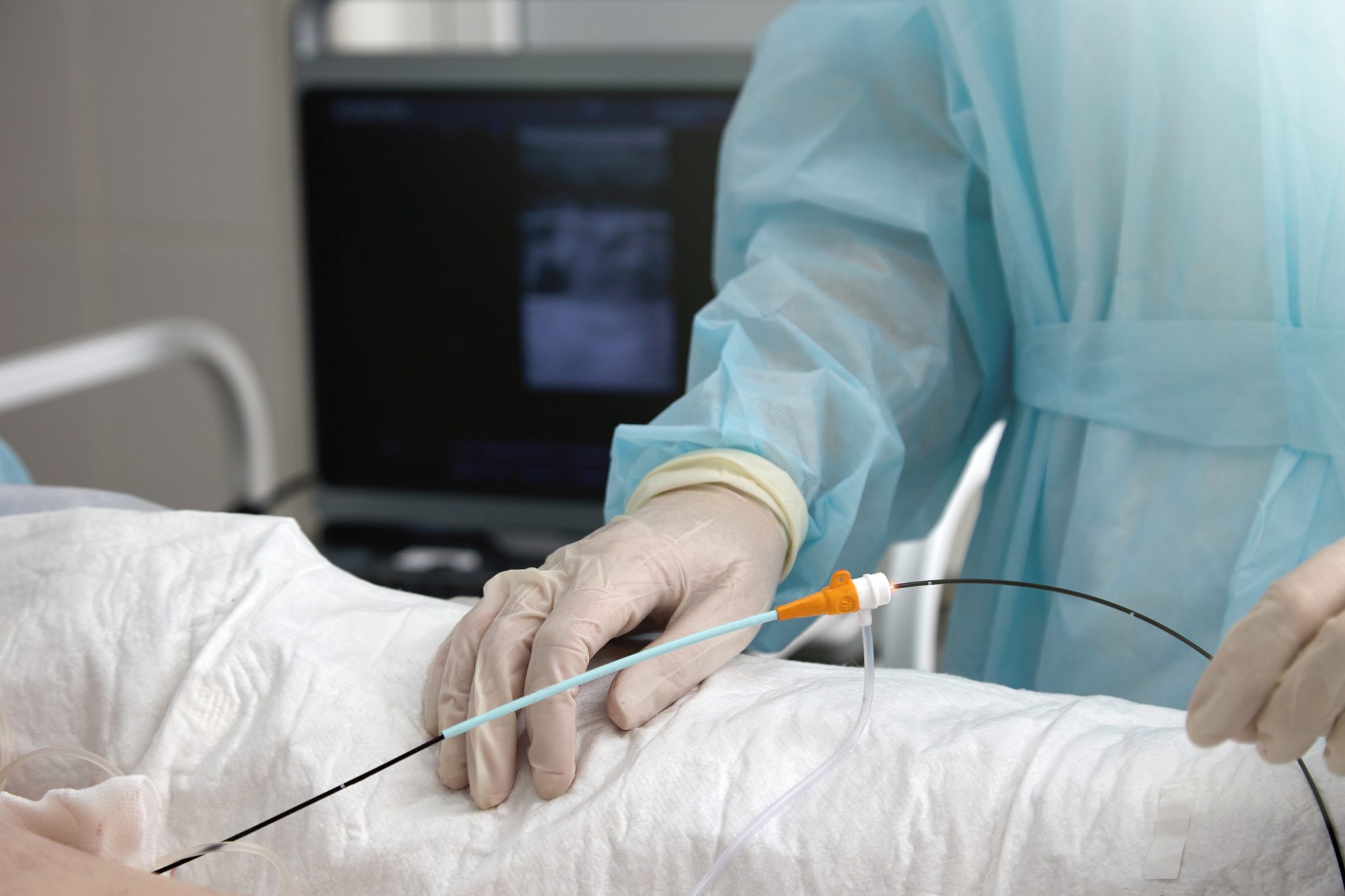 Medical professional wearing surgical gloves and a blue gown performing a minimally invasive procedure using a catheter-like device, with ultrasound equipment in the background.